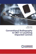 Conventional Radiography & CBCT in Localising Impacted Canines - Aditya Talwar