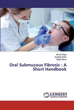 Oral Submucous Fibrosis - Shruti Singh