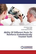 Ability Of Different Posts To Reinforce Endodontically Treated Teeth - Abdulrahman Fadag