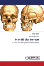 Mandibular Defects - Amrit Tandan