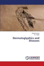 Dermatoglyphics and Diseases - Monika Kumari