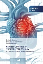 Clinical Outcome of Thrombolytic Therapy - Dr. Leila Ostovar