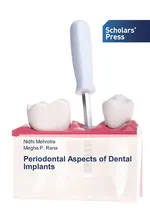 Periodontal Aspects of Dental Implants - Nidhi Mehrotra