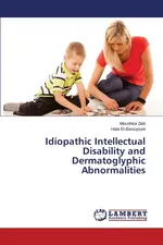 Idiopathic Intellectual Disability and Dermatoglyphic Abnormalities - Moushira Zaki