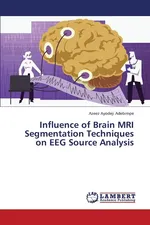 Influence of Brain MRI Segmentation Techniques on Eeg Source Analysis - Azeez Ayodeji Adebimpe