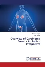 Overview of Carcinoma Breast - An Indian Prespective - Sameer Gupta
