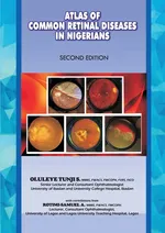 The Atlas of Retinal Diseases in Nigerians - Oluleye S. Tunji