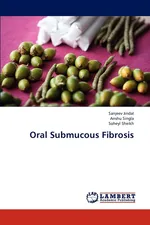 Oral Submucous Fibrosis - Sanjeev Jindal