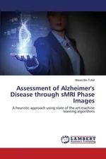Assessment of Alzheimer's Disease Through Smri Phase Images - Ahsan Bin Tufail
