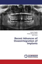 Recent Advances of Osseointegration of Implants - Anshul Singhal
