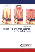 Diagnosis and Management of Root Fractures - Haque Shehla W.