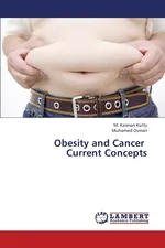 Obesity and Cancer   Current Concepts - M. Kannan Kutty