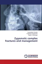 Zygomatic complex fractures and management - Kanwaldeep Soodan