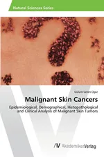 Malignant Skin Cancers - Gülüm Ceren Ogur