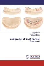 Designing of Cast Partial Denture - Pragati Rawat