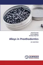 Alloys in Prosthodontics - Vishal Rometra
