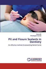 Pit and Fissure Sealants in Dentistry - Henna Mir