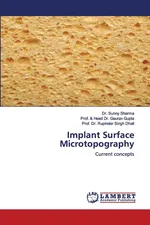 Implant Surface Microtopography - Dr. Sunny Sharma
