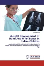 Skeletal Development Of Hand And Wrist Bones In Indian Children - Sumit T. Patil