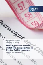 Obesity; most common metabolic complication in Prader-Willi syndrome - Youness Eman Refaat
