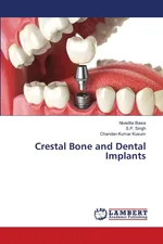 Crestal Bone and Dental Implants - Nivedita Bawa