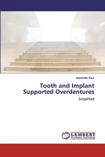Tooth and Implant Supported Overdentures - Jaswinder Kaur