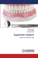 Zygomatic implant - Chetan Krishna