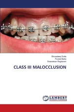 CLASS III MALOCCLUSION - Shuvadeep Dutta