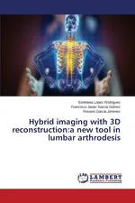 Hybrid imaging with 3D reconstruction - Rodríguez Estefanía López