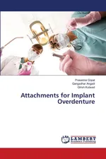 Attachments for Implant Overdenture - Prasanna Gopal