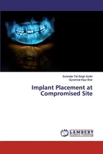 Implant Placement at Compromised Site - Surender Pal Singh Sodhi