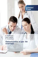 Osteomyelitis of jaw -An overview - R. Muthunagai