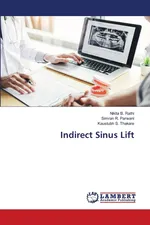 Indirect Sinus Lift - Nikita B. Rathi