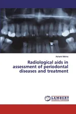 Radiological aids in assessment of periodontal diseases and treatment - Ashank Mishra