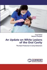 An Update on White Lesions of the Oral Cavity - Pooja Rathod