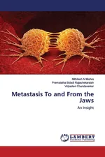 Metastasis To and From the Jaws - Mithilesh N Mishra