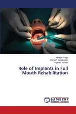 Role of Implants in Full Mouth Rehabilitation - Ajinkya Wagh