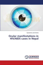 Ocular manifestations in HIV/AIDS cases in Nepal - Gyanendra Lamichhane