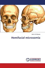 Hemifacial microsomia - Mosawi Aamir Al