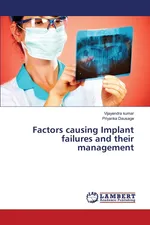 Factors causing Implant failures and their management - Vijayendra Kumar