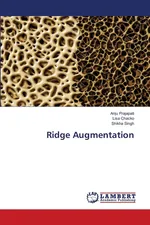 Ridge Augmentation - Anju Prajapati