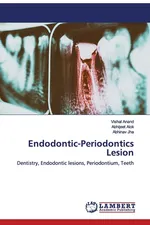 Endodontic-Periodontics Lesion - Vishal Anand