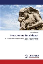 Intrauterine fetal death - Alessio Battistini