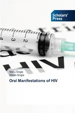 Oral Manifestations of HIV - Nishu Singla