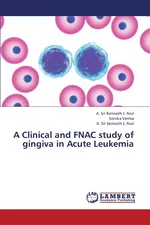 A Clinical and Fnac Study of Gingiva in Acute Leukemia - Arul A. Sri Kennath J.