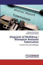Diagnosis of Multidrug / Rifampicin Resistant Tuberculosis - Blackson Pitolo Tembo