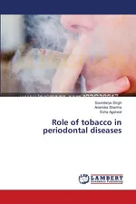 Role of tobacco in periodontal diseases - Soundarya Singh