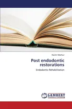 Post endodontic restorations - Rachit Mathur