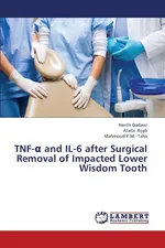 Tnf- And Il-6 After Surgical Removal of Impacted Lower Wisdom Tooth - Harith Qadawi