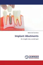 Implant Abutments - Madhumita Sachdeva